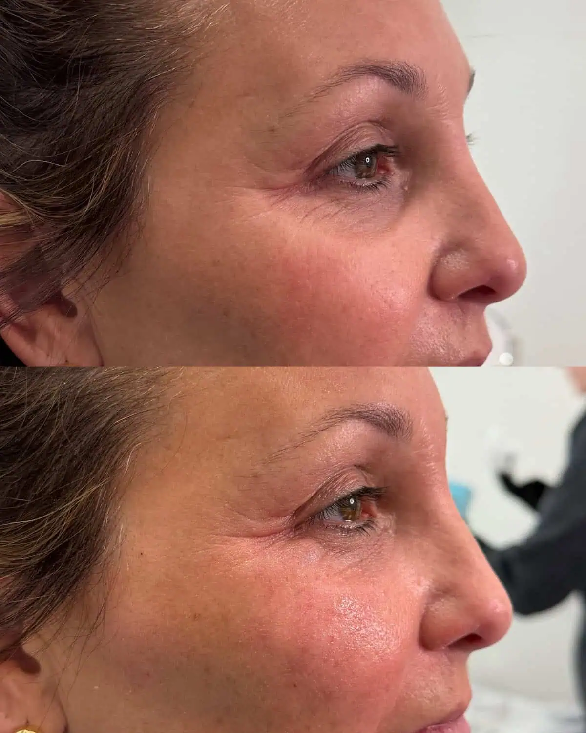 Before and after treatment results