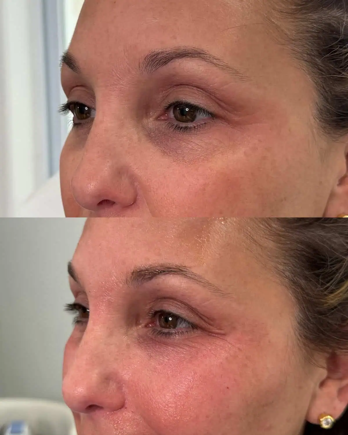 Before and after treatment results