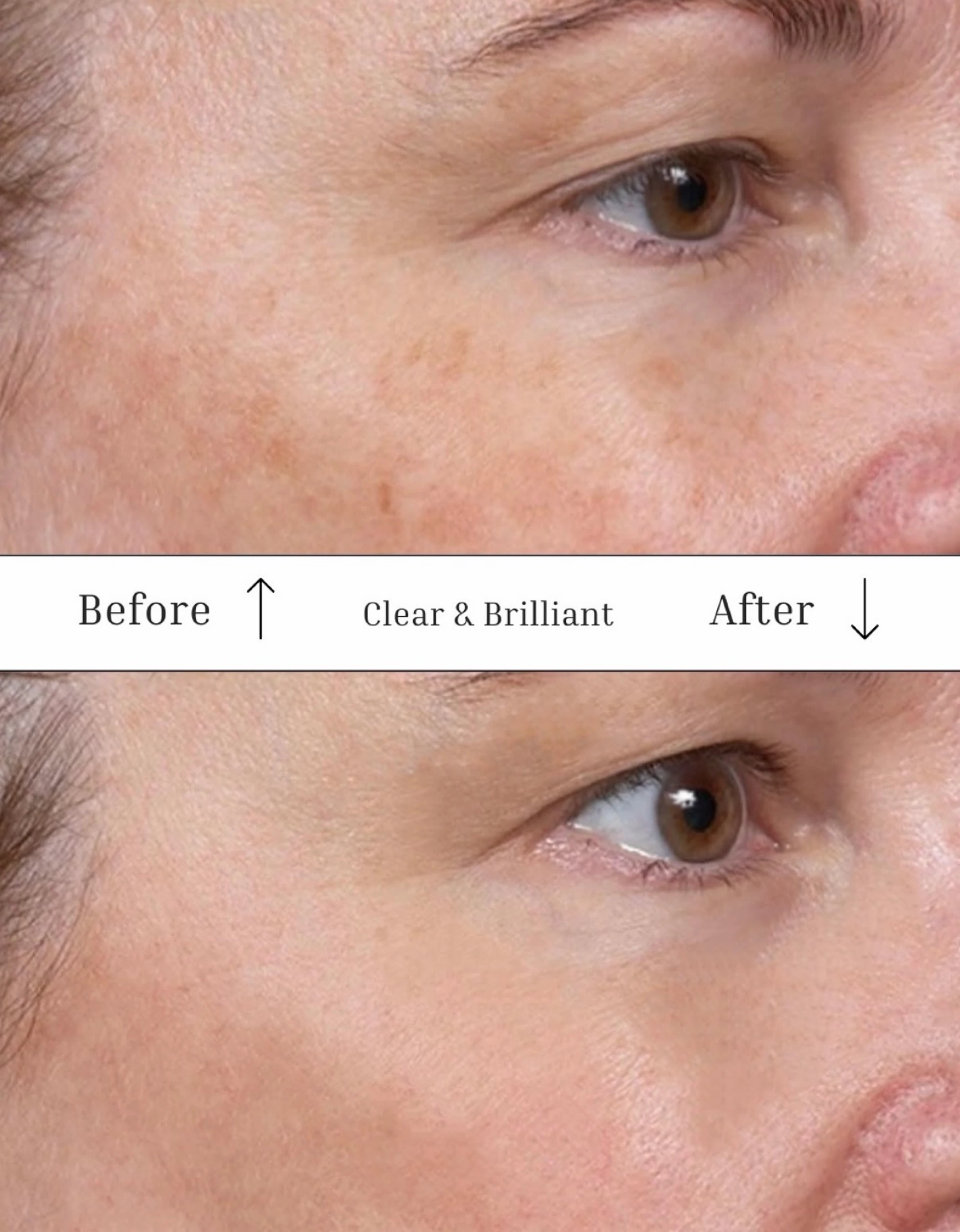 Woman relaxing during a facial