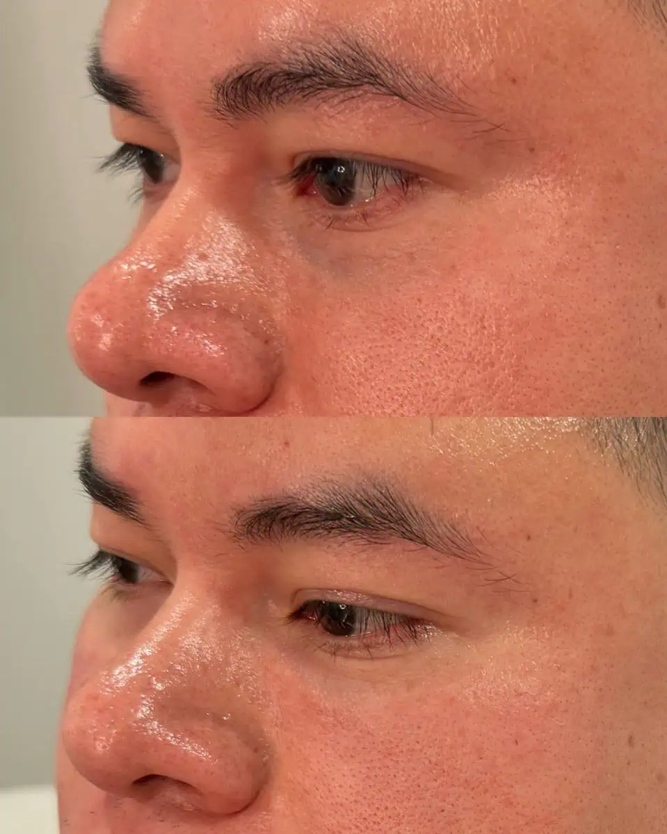Before and after treatment results