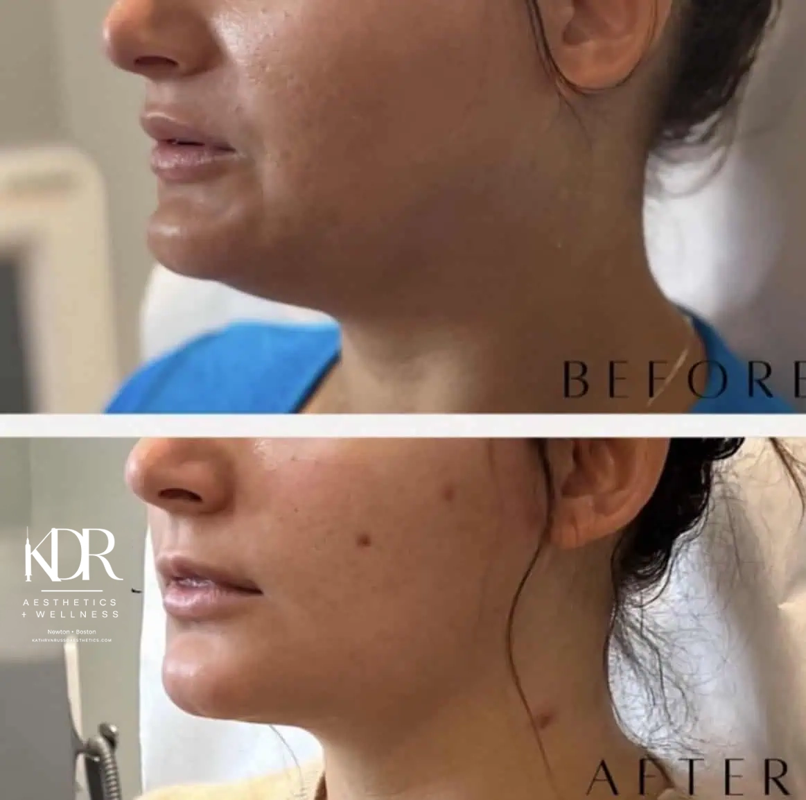 Before and after treatment results